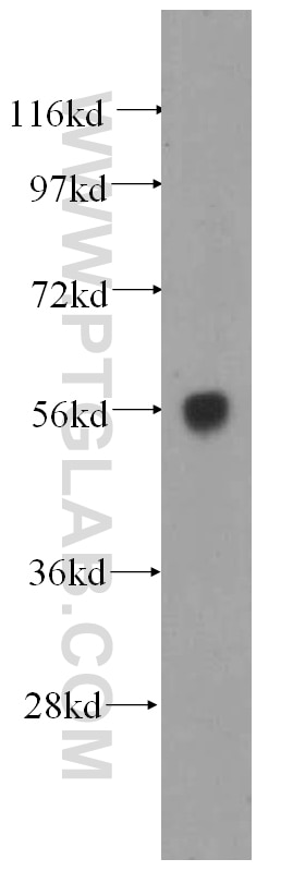 DNAJC7 Polyclonal antibody