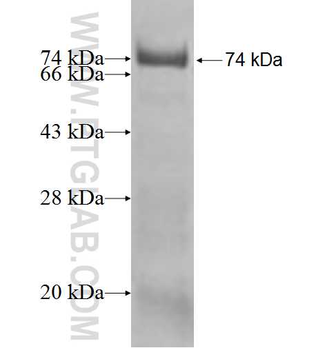 DNAJC7 fusion protein Ag1572 SDS-PAGE