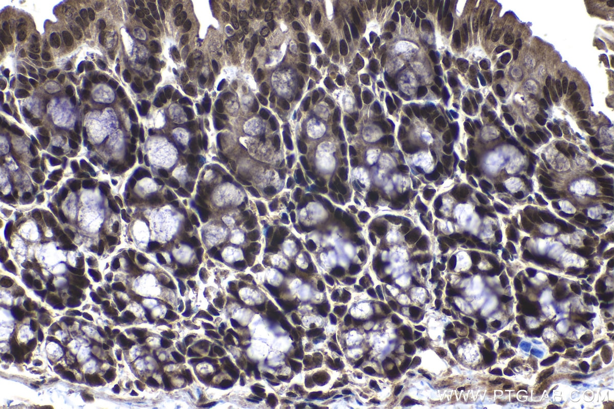 Immunohistochemistry (IHC) staining of mouse colon tissue using DNAJC9 Polyclonal antibody (25444-1-AP)