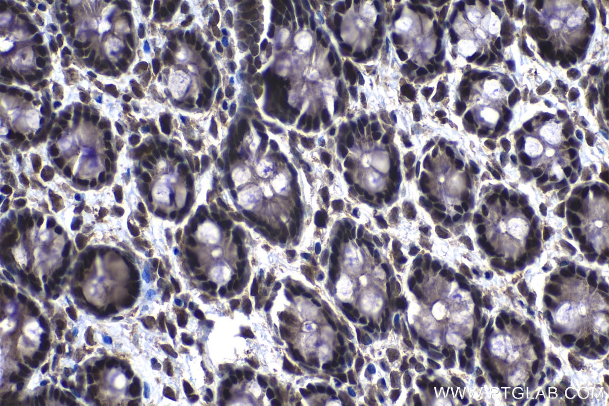 Immunohistochemistry (IHC) staining of rat colon tissue using DNAJC9 Polyclonal antibody (25444-1-AP)
