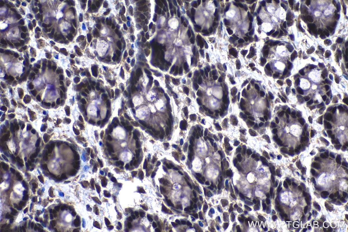 IHC staining of rat colon using 25444-1-AP