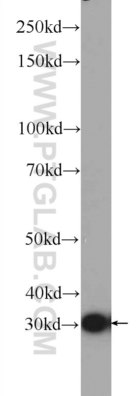 WB analysis of HEK-293 using 25444-1-AP