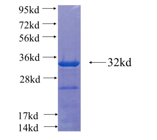 DNAJC9 fusion protein Ag22123 SDS-PAGE