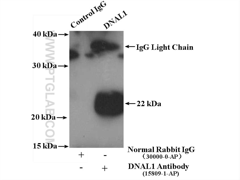 Immunoprecipitation (IP) experiment of HeLa cells using DNAL1 Polyclonal antibody (15809-1-AP)