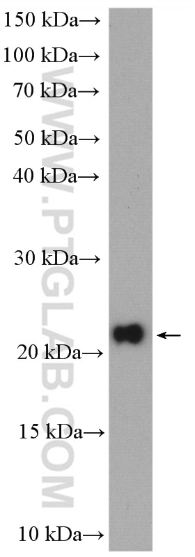 Western Blot (WB) analysis of HeLa cells using DNAL1 Polyclonal antibody (15809-1-AP)