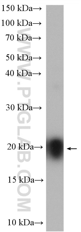 Western Blot (WB) analysis of mouse brain tissue using DNAL1 Polyclonal antibody (15809-1-AP)