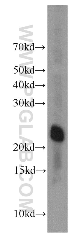 Western Blot (WB) analysis of human brain tissue using DNAL1 Polyclonal antibody (15809-1-AP)