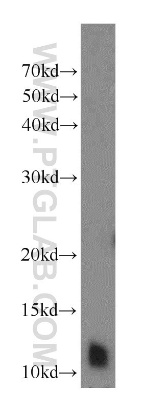 Western Blot (WB) analysis of mouse testis tissue using DNAL4 Polyclonal antibody (10388-1-AP)