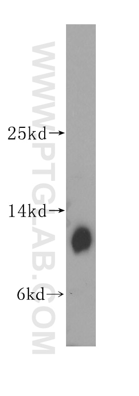 Western Blot (WB) analysis of HEK-293 cells using DNAL4 Polyclonal antibody (10388-1-AP)