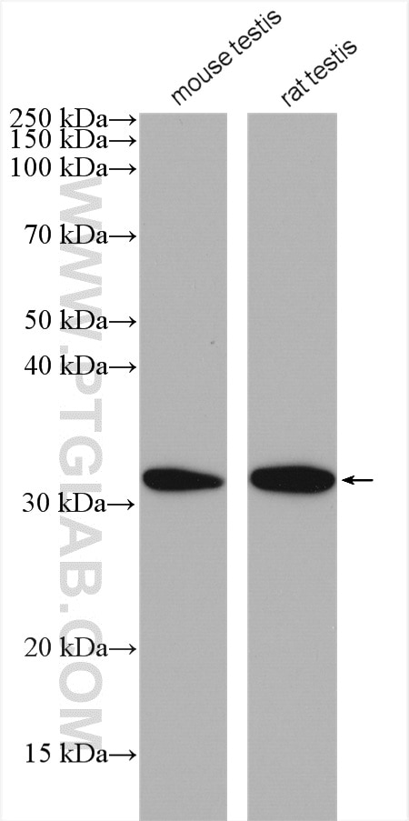 Western Blot (WB) analysis of various lysates using DNALI1 Polyclonal antibody (17601-1-AP)