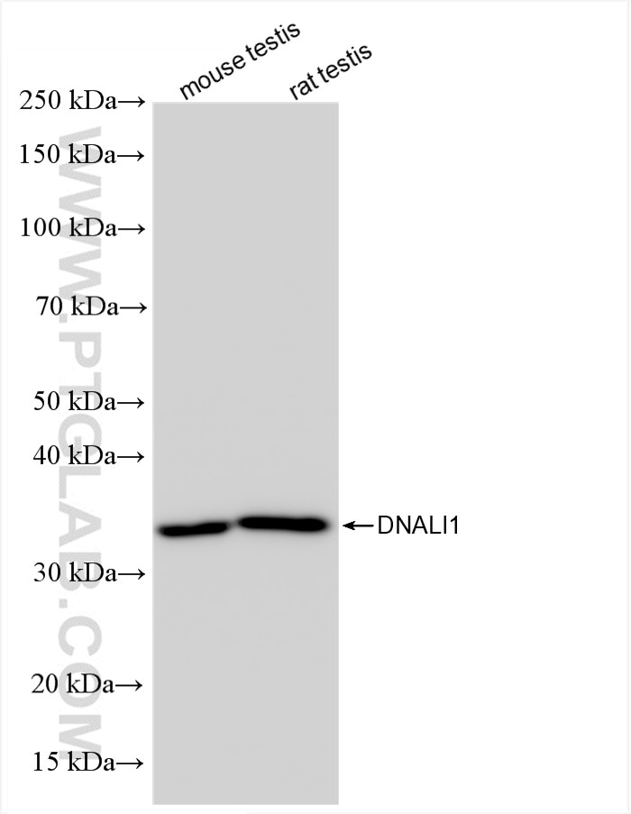 Western Blot (WB) analysis of various lysates using DNALI1 Recombinant antibody (85734-1-RR)