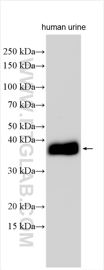 Western Blot (WB) analysis of various lysates using DNase I Polyclonal antibody (16659-1-AP)