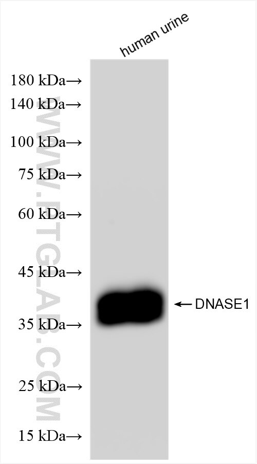 DNase I