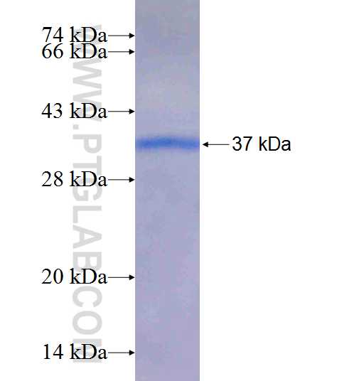 DNASE1 fusion protein Ag9931 SDS-PAGE