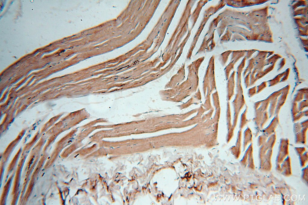 Immunohistochemistry (IHC) staining of human skeletal muscle tissue using DNASE1L1 Polyclonal antibody (13653-1-AP)