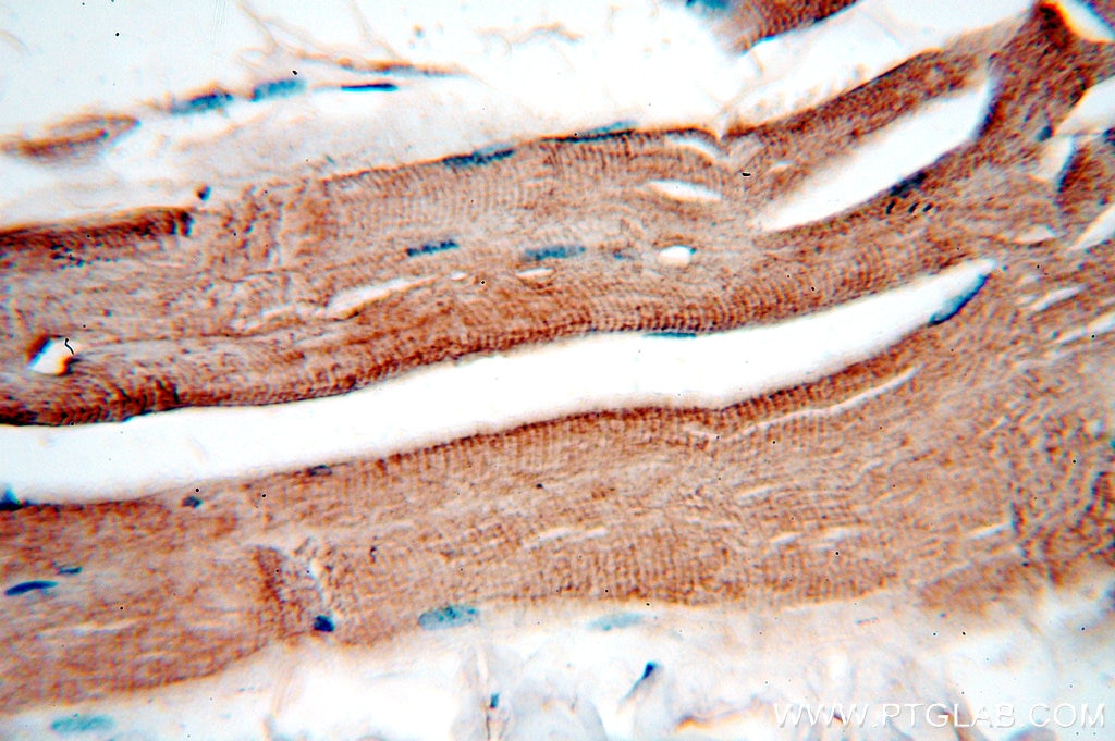 Immunohistochemistry (IHC) staining of human skeletal muscle tissue using DNASE1L1 Polyclonal antibody (13653-1-AP)