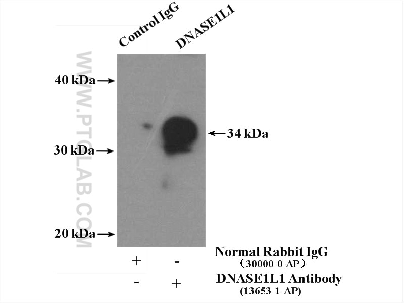 Immunoprecipitation (IP) experiment of mouse skeletal muscle tissue using DNASE1L1 Polyclonal antibody (13653-1-AP)