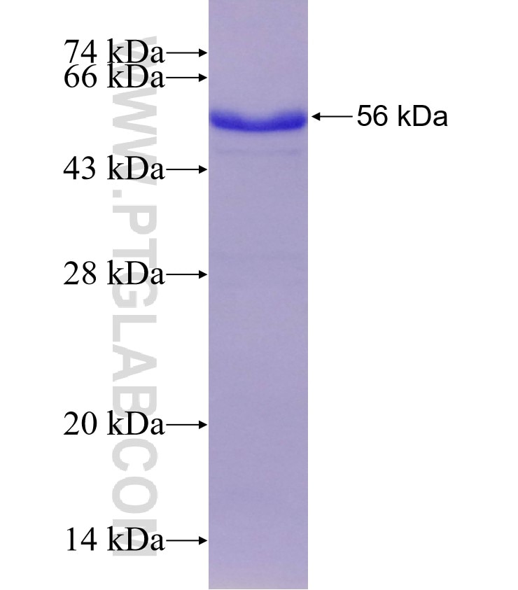 DNASE1L1 fusion protein Ag4222 SDS-PAGE