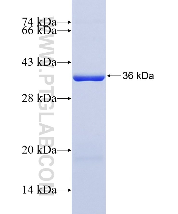 DNASE1L2 fusion protein Ag11270 SDS-PAGE