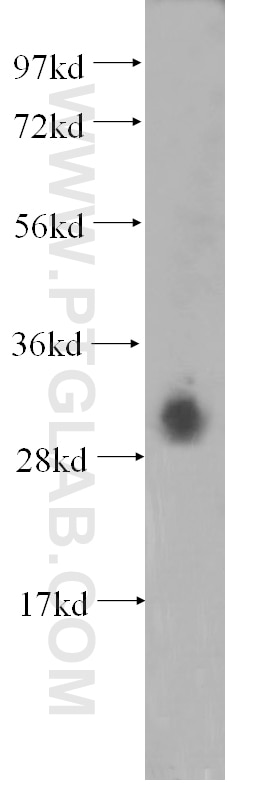 Western Blot (WB) analysis of HEK-293 cells using DNASE1L3 Polyclonal antibody (11330-1-AP)