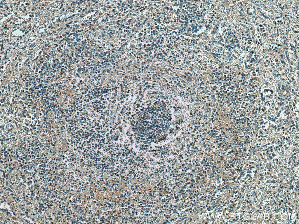 Immunohistochemistry (IHC) staining of human spleen tissue using DNASE1L3 Monoclonal antibody (67041-1-Ig)