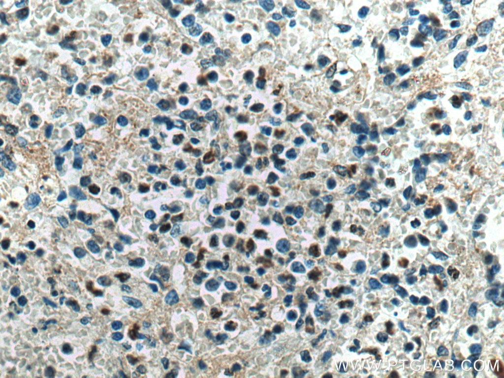 Immunohistochemistry (IHC) staining of human spleen tissue using DNASE1L3 Monoclonal antibody (67041-1-Ig)