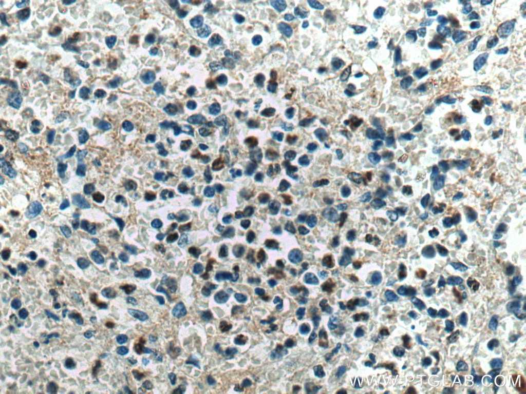 IHC staining of human spleen using 67041-1-Ig