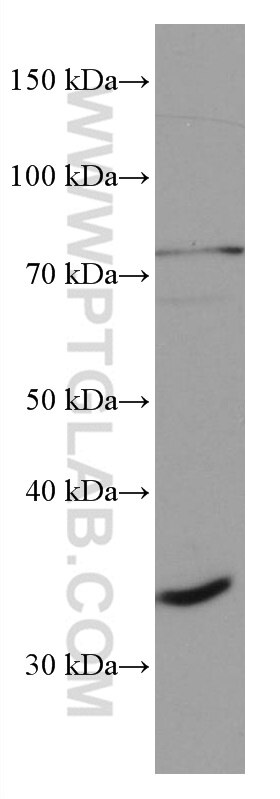 WB analysis of Daudi using 67041-1-Ig