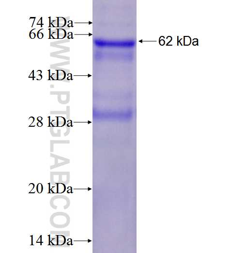 DNASE1L3 fusion protein Ag1873 SDS-PAGE