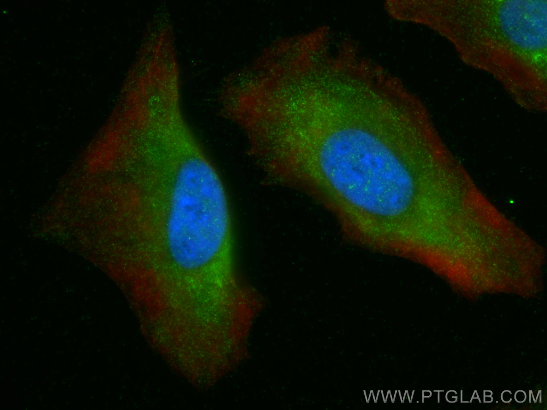 Immunofluorescence (IF) / fluorescent staining of HeLa cells using DNASE2 Polyclonal antibody (15934-1-AP)