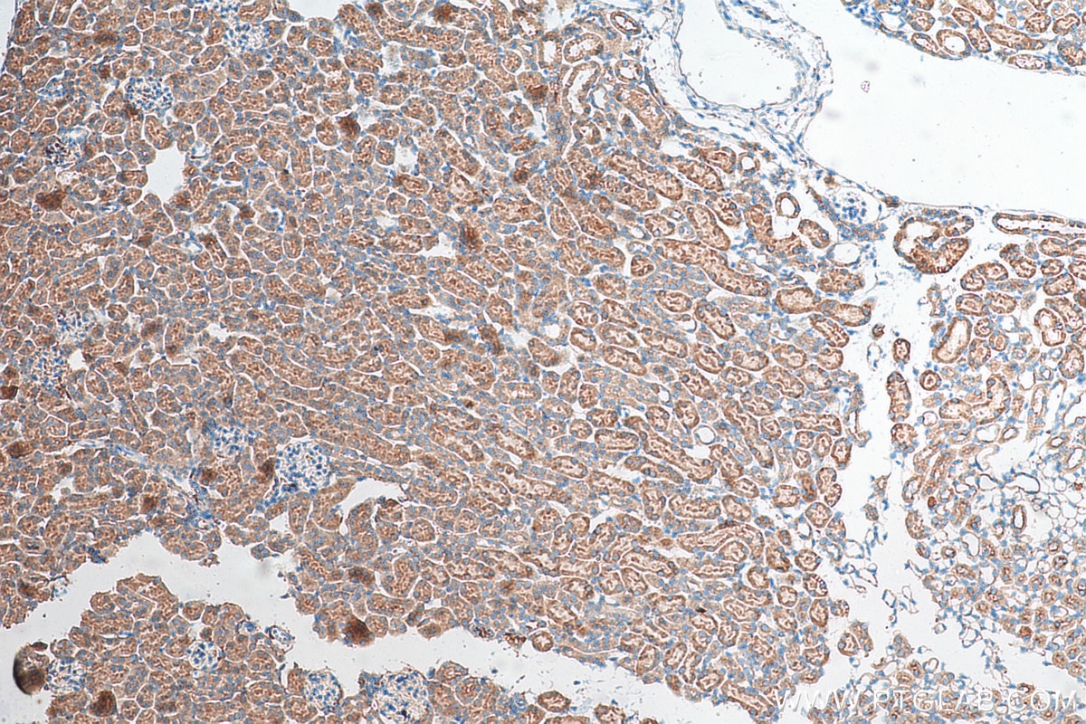IHC staining of mouse kidney using 15934-1-AP