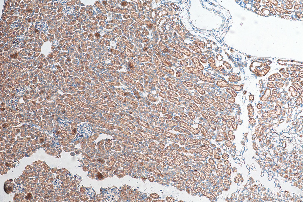 Immunohistochemistry (IHC) staining of mouse kidney tissue using DNASE2 Polyclonal antibody (15934-1-AP)