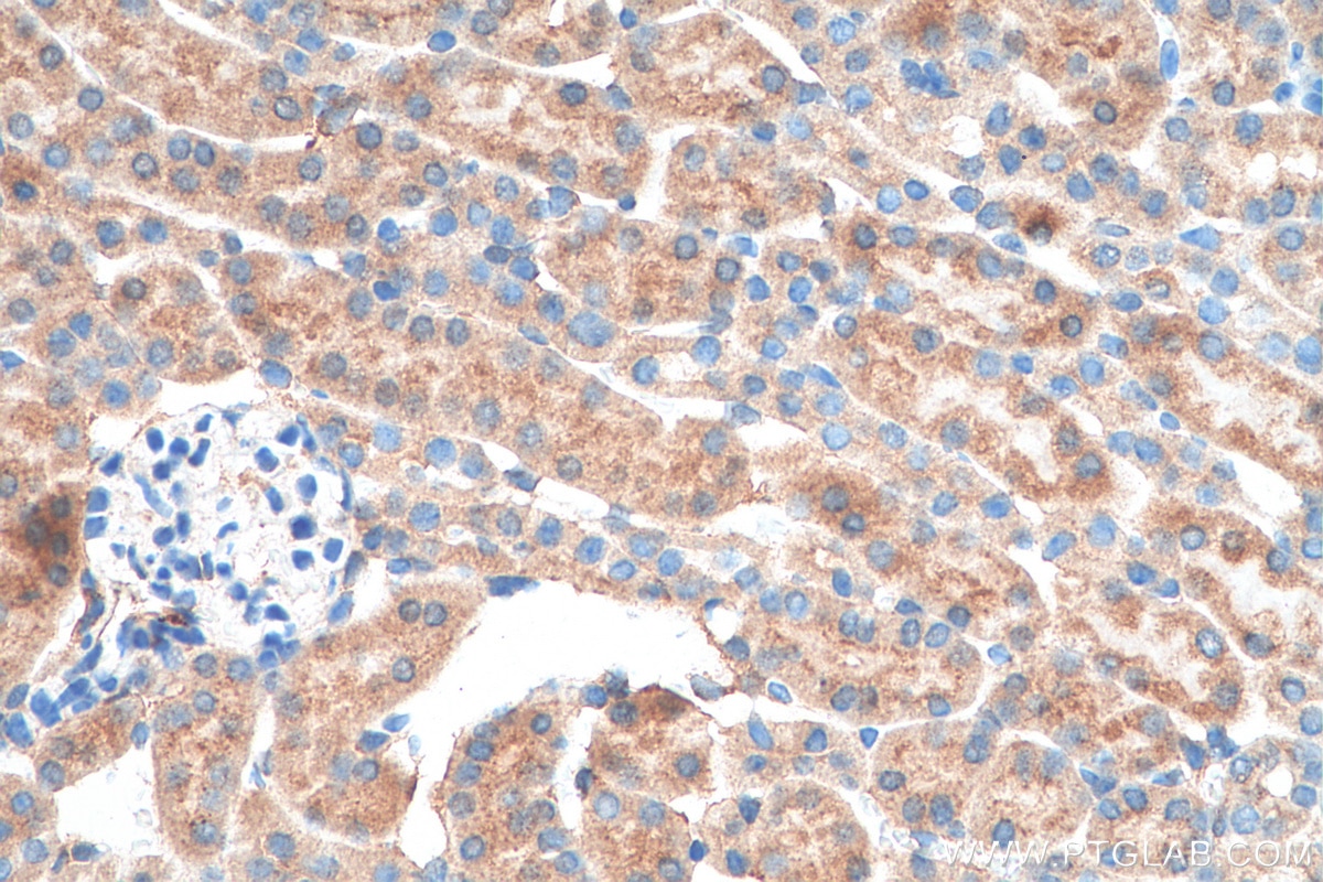 Immunohistochemistry (IHC) staining of mouse kidney tissue using DNASE2 Polyclonal antibody (15934-1-AP)