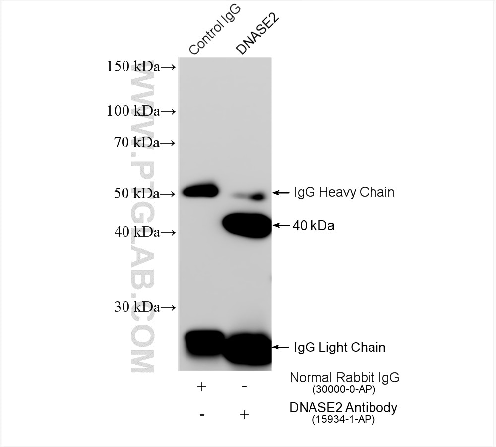 Immunoprecipitation (IP) experiment of HeLa cells using DNASE2 Polyclonal antibody (15934-1-AP)