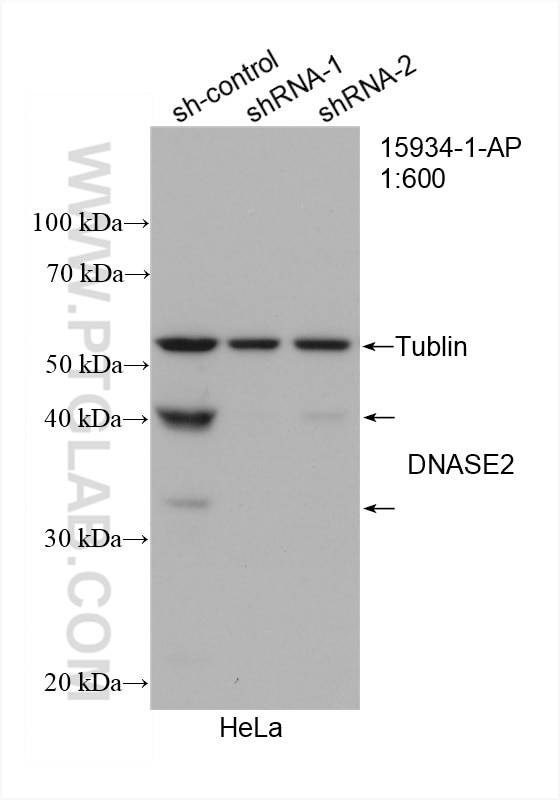 WB analysis of HeLa using 15934-1-AP