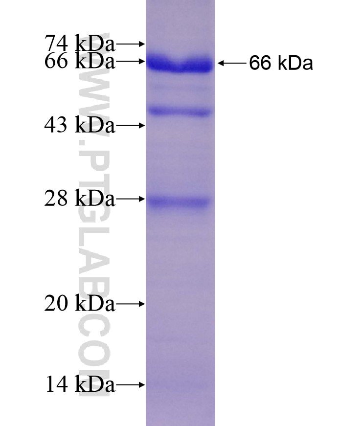 DNASE2 fusion protein Ag8781 SDS-PAGE