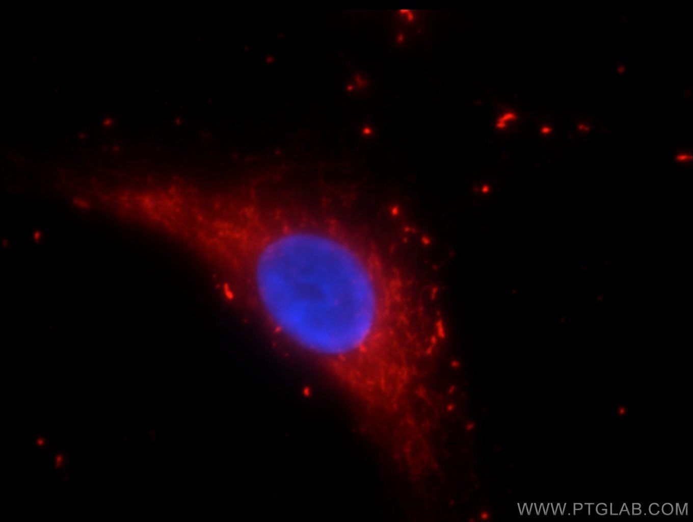Immunofluorescence (IF) / fluorescent staining of A549 cells using DNASE2B Polyclonal antibody (22652-1-AP)