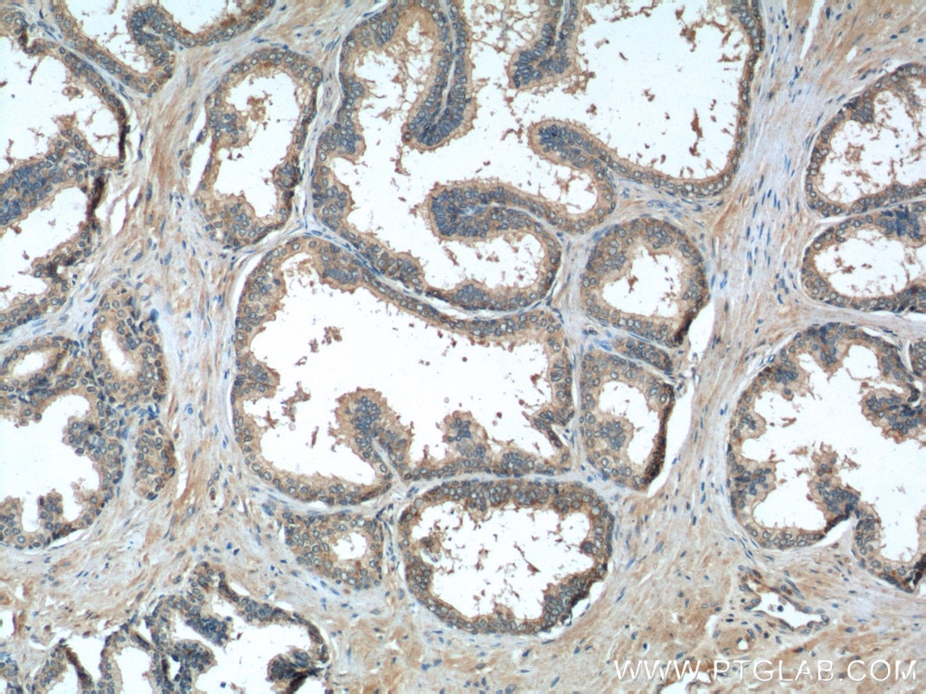 Immunohistochemistry (IHC) staining of human prostate hyperplasia tissue using DNASE2B Polyclonal antibody (22652-1-AP)