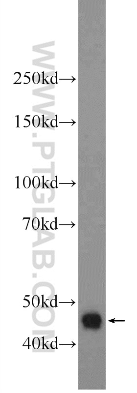 Western Blot (WB) analysis of Jurkat cells using DNASE2B Polyclonal antibody (22652-1-AP)