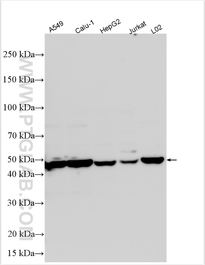 Western Blot (WB) analysis of various lysates using DNASE2B Polyclonal antibody (22652-1-AP)