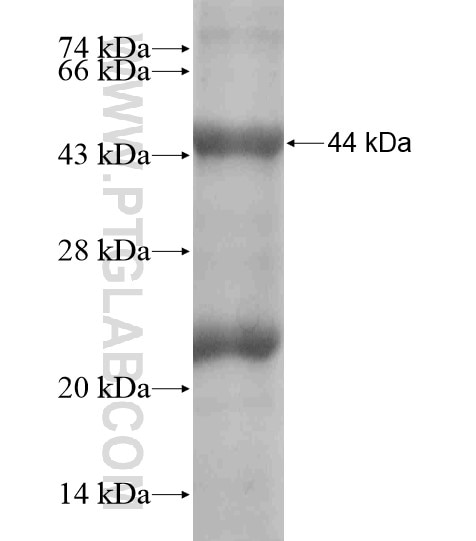 DNASE2B fusion protein Ag18595 SDS-PAGE