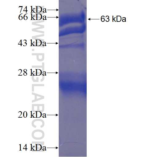 DND1 fusion protein Ag4415 SDS-PAGE