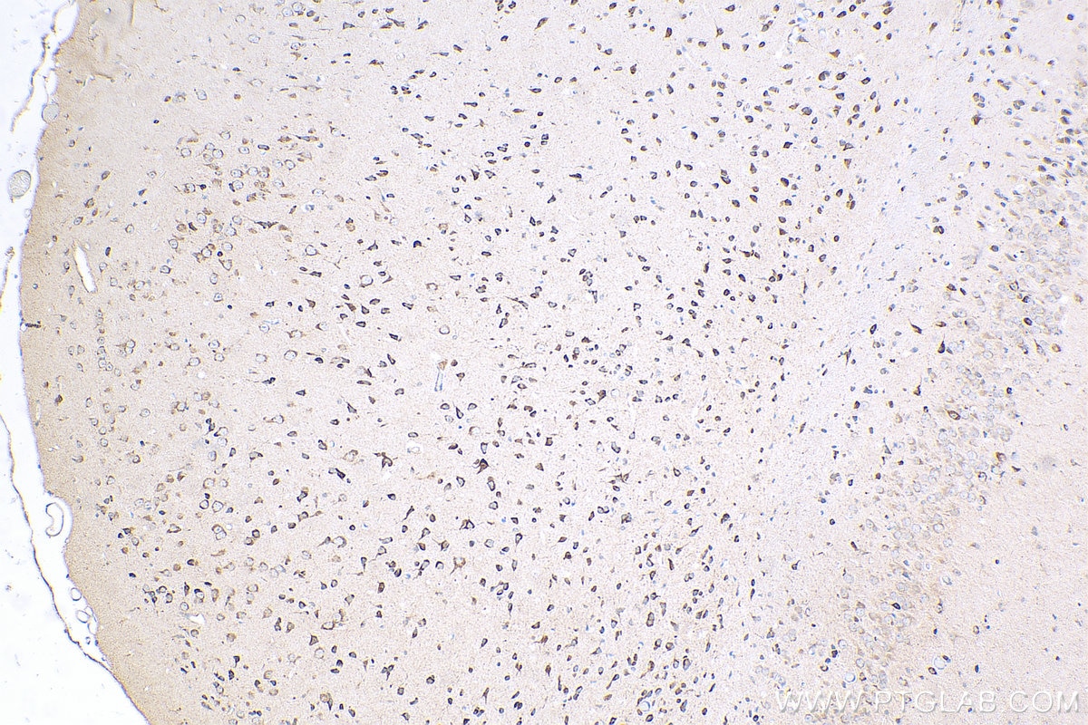 Immunohistochemistry (IHC) staining of mouse brain tissue using DNER Polyclonal antibody (24362-1-AP)