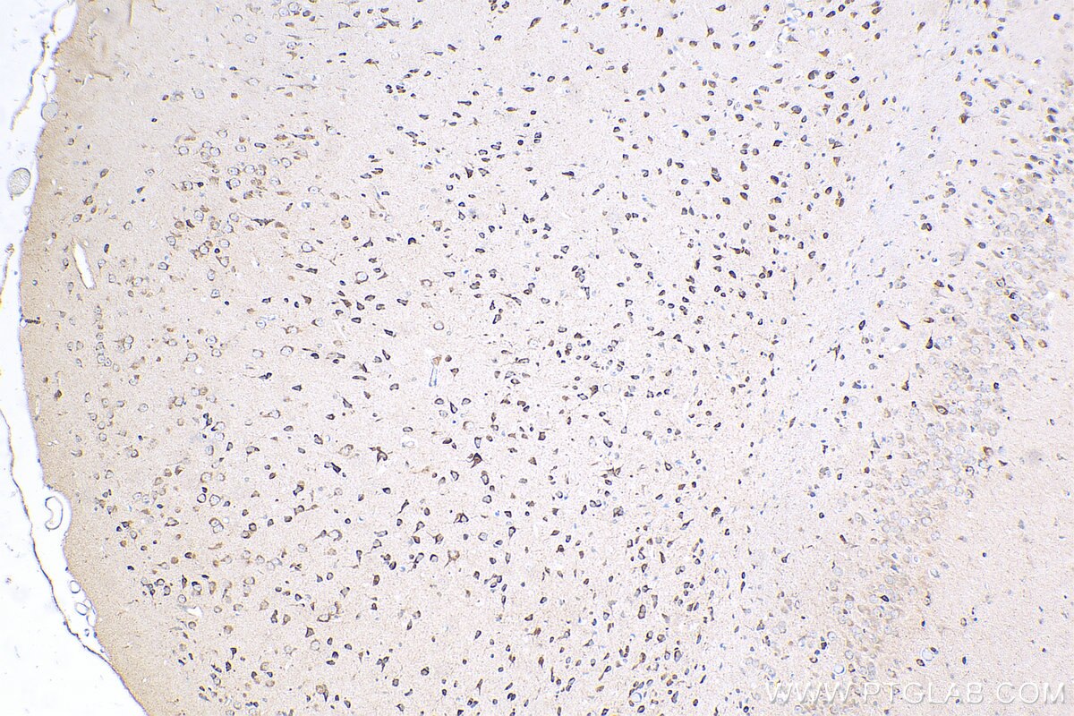 Immunohistochemistry (IHC) staining of mouse brain tissue using DNER Polyclonal antibody (24362-1-AP)