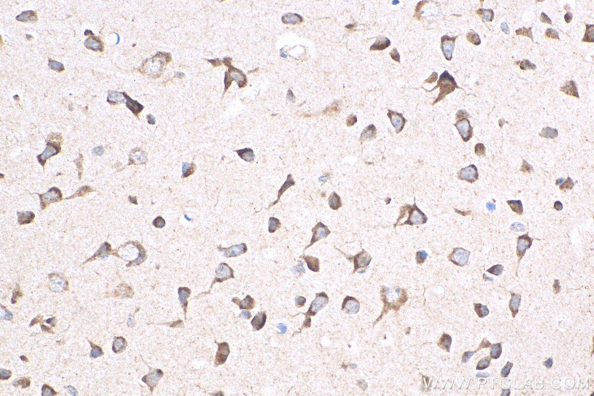 IHC staining of mouse brain using 24362-1-AP