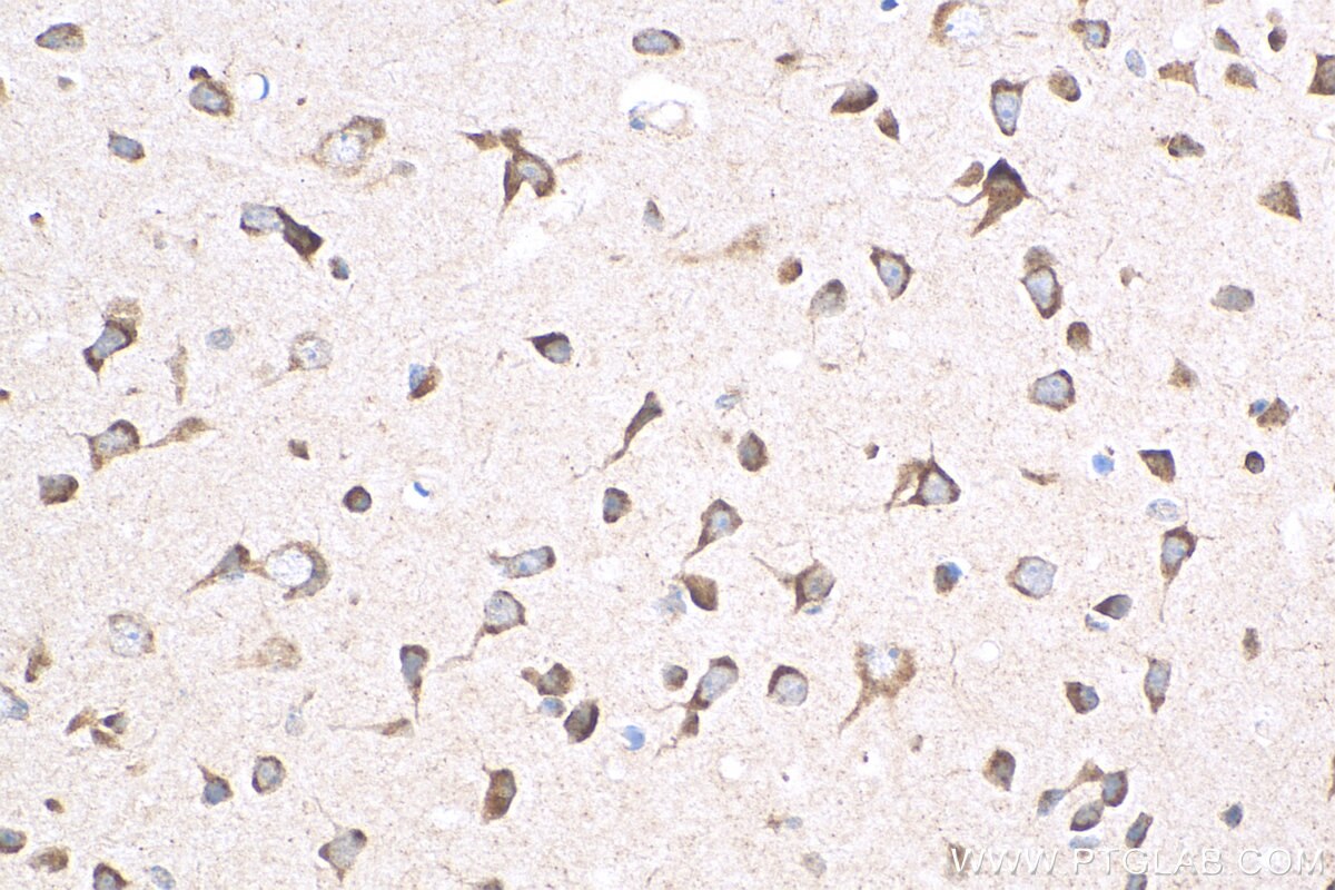 Immunohistochemistry (IHC) staining of mouse brain tissue using DNER Polyclonal antibody (24362-1-AP)