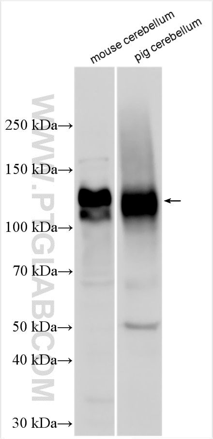 Western Blot (WB) analysis of various lysates using DNER Polyclonal antibody (24362-1-AP)