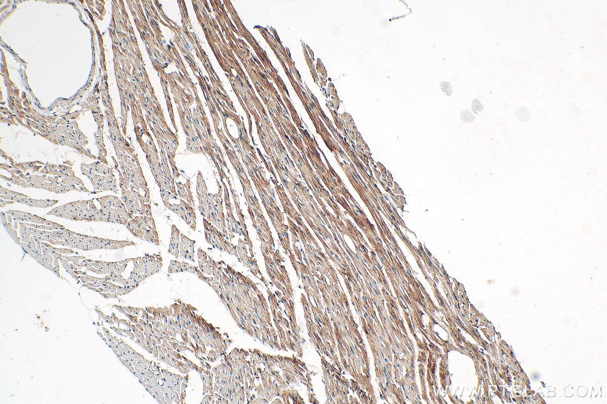 Immunohistochemistry (IHC) staining of rat heart tissue using DNLZ Polyclonal antibody (31844-1-AP)