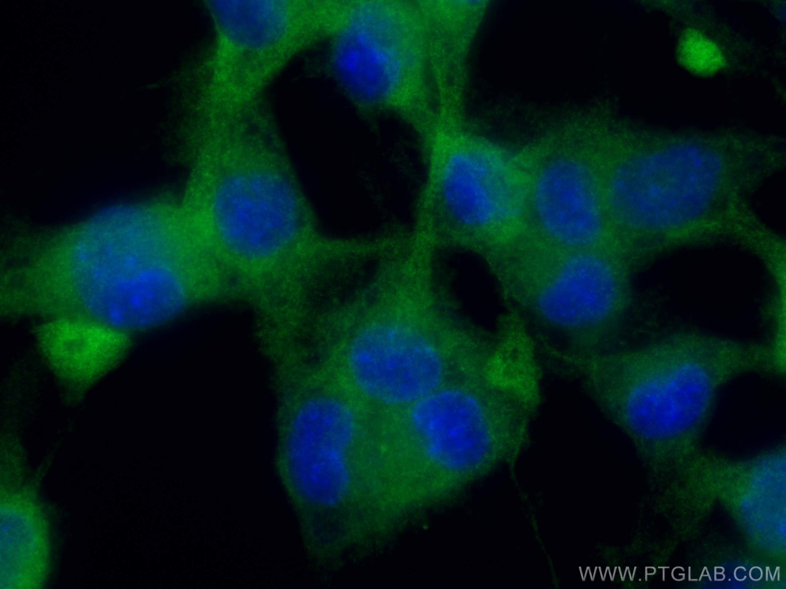 Immunofluorescence (IF) / fluorescent staining of Neuro-2a cells using Dynamin 1 Polyclonal antibody (18205-1-AP)