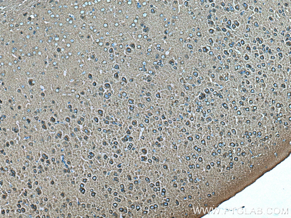 Immunohistochemistry (IHC) staining of mouse brain tissue using Dynamin 1 Polyclonal antibody (18205-1-AP)